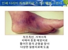 유미테라피는 일반인을 위한 자병자치 건강법이다.
