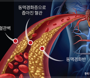 장내 미생물이 나쁘면 건강식도 무용지물이다