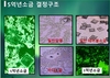 암과 칼슘 2 