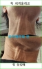 다양한 질환을 유발하는 '설골뼈 왜곡' 