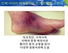 [신기한 유미테라피 DIY건강법 ] 유미테라피의 효과와 구체적 천사봉 사용법 