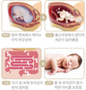 미생물 샤워와 농약 샤워