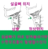 수면무호흡  해결법